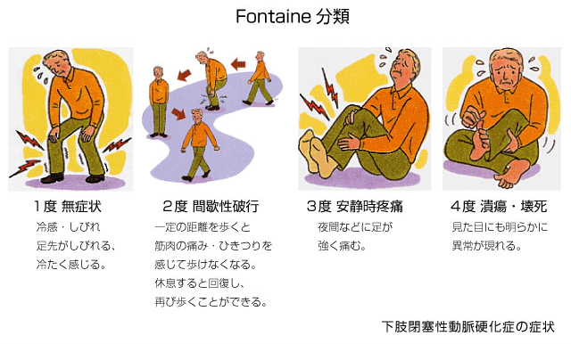 Fontaine 分類