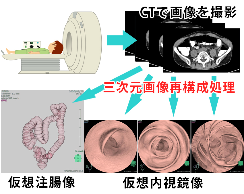大腸CTドック