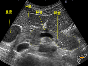 【腹部超音波検査画像】