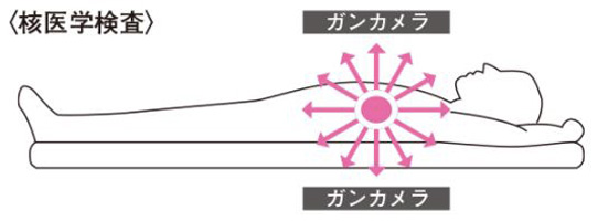 核医学検査