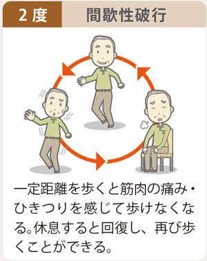 下肢閉塞性動脈硬化症症状2